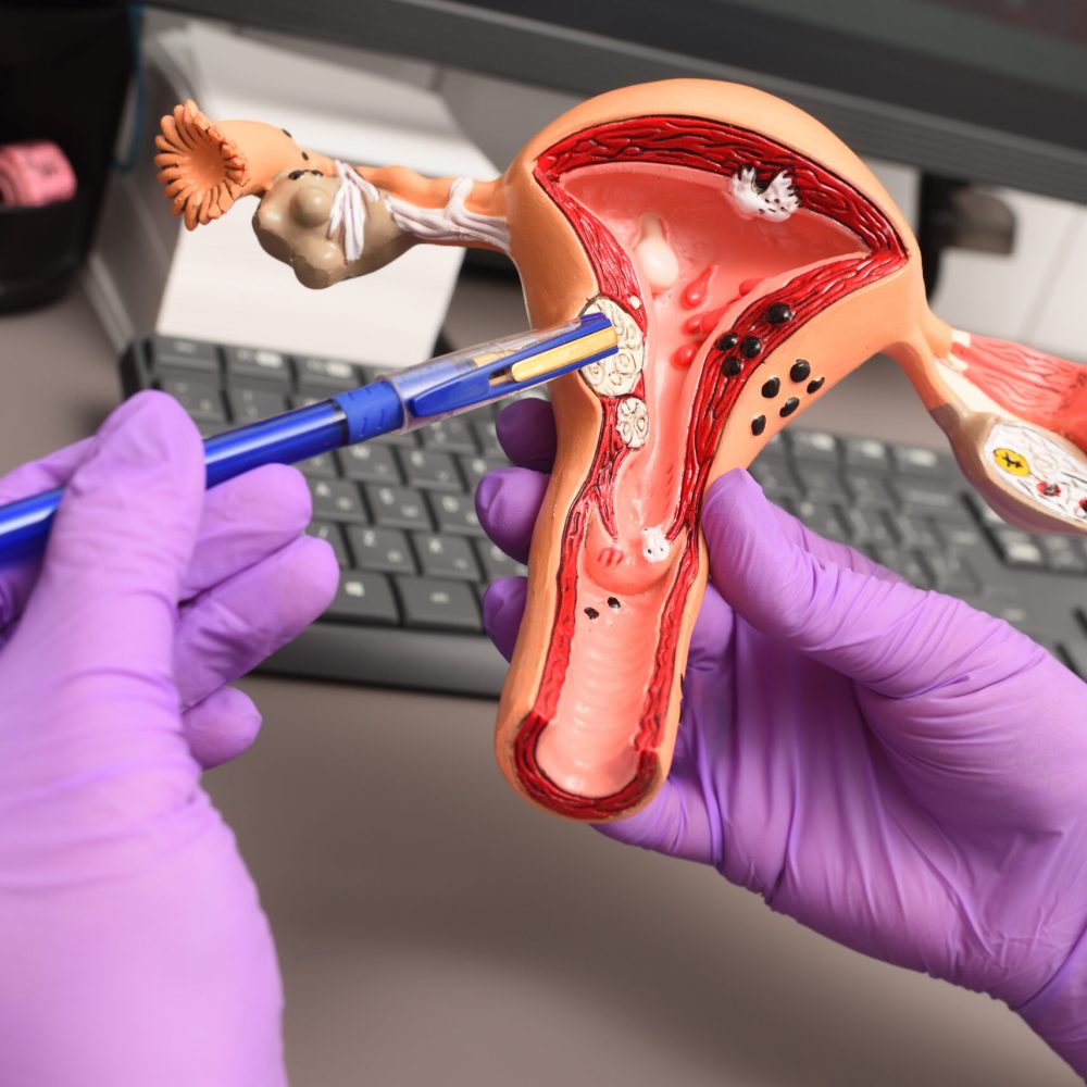 Expert Gynecological Solutions in Kolkata